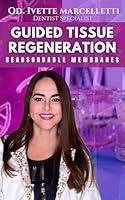 Algopix Similar Product 4 - Guided tissue regeneration Resorbable