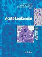 Algopix Similar Product 8 - Hematologic Malignancies Acute