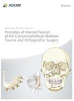 Algopix Similar Product 18 - Principles of Internal Fixation of the