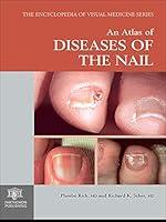 Algopix Similar Product 12 - An Atlas of Diseases of the Nail