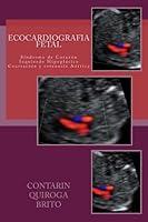 Algopix Similar Product 10 - Ecocardiografia Fetal (Spanish Edition)