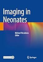 Algopix Similar Product 2 - Imaging in Neonates