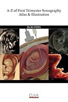 Algopix Similar Product 18 - AZ of First Trimester Sonography Atlas