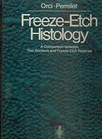 Algopix Similar Product 10 - Freezeetch histology A comparison