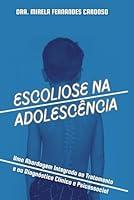 Algopix Similar Product 10 - Escoliose na Adolescncia Uma