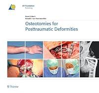 Algopix Similar Product 13 - Osteotomies for Posttraumatic