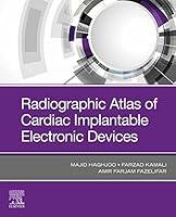 Algopix Similar Product 11 - Radiographic Atlas of Cardiac