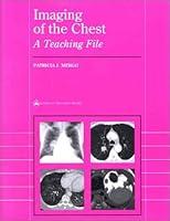 Algopix Similar Product 2 - Imaging of the Chest: A Teaching File