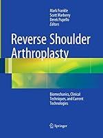 Algopix Similar Product 2 - Reverse Shoulder Arthroplasty