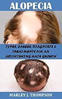 Algopix Similar Product 9 - ALOPECIA TYPES CAUSES DIAGNOSIS 