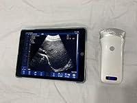 Algopix Similar Product 16 - SonoQue o2 Lifecare Wireless Veterinary