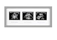 Algopix Similar Product 10 - Pearhead Triple Sonogram Picture Frame
