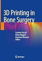 Algopix Similar Product 4 - 3D Printing in Bone Surgery