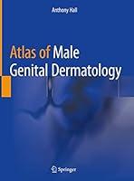 Algopix Similar Product 12 - Atlas of Male Genital Dermatology