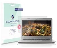 Algopix Similar Product 7 - iLLumiShield Matte Screen Protector