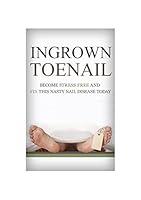 Algopix Similar Product 6 - Foot Pain Ingrown Toenail How To