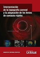 Algopix Similar Product 19 - Interpretacin de la topografa corneal