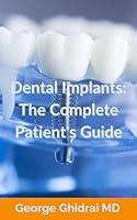 Algopix Similar Product 19 - Dental Implants The Complete Patients