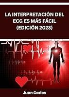 Algopix Similar Product 9 - INTERPRETACIN DEL ECG ES MS FCIL