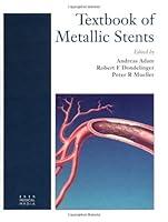 Algopix Similar Product 8 - Textbook of Metallic Stents