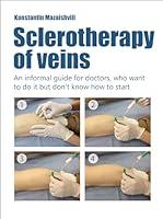 Algopix Similar Product 10 - Sclerotherapy of Veins  An informal