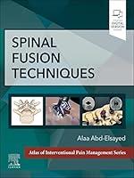 Algopix Similar Product 19 - Spinal Fusion Techniques - E-Book
