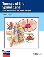 Algopix Similar Product 4 - Tumors of the Spinal Canal Surgical