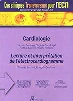 Algopix Similar Product 9 - CARDIOLOGIE LECTURE D ECG CAS CLINIQUES