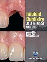Algopix Similar Product 9 - Implant Dentistry at a Glance At a
