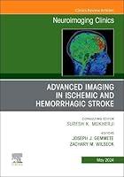 Algopix Similar Product 2 - Advanced Imaging in Ischemic and