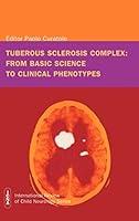 Algopix Similar Product 10 - Tuberous Sclerosis Complex From Basic