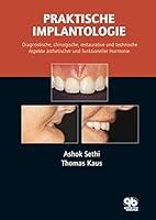 Algopix Similar Product 4 - Praktische Implantologie