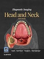 Algopix Similar Product 9 - Diagnostic Imaging: Head and Neck E-Book
