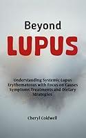 Algopix Similar Product 2 - Beyond Lupus  Understanding Systemic