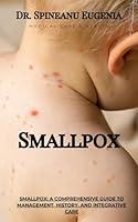 Algopix Similar Product 19 - Smallpox A Comprehensive Guide to