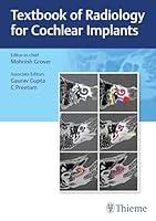 Algopix Similar Product 20 - Textbook of Radiology for Cochlear