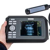 Algopix Similar Product 8 - Portable Ultrasound Scanner for