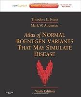 Algopix Similar Product 6 - Atlas of Normal Roentgen Variants That