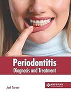 Algopix Similar Product 7 - Periodontitis: Diagnosis and Treatment