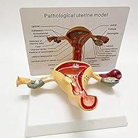 Algopix Similar Product 14 - GYJ Uterine Pathological Model Uterus
