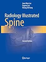 Algopix Similar Product 11 - Radiology Illustrated: Spine