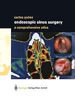 Algopix Similar Product 18 - Endoscopic Sinus Surgery A
