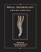 Algopix Similar Product 19 - Spinal Arthroplasty A New Era in Spine