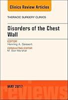 Algopix Similar Product 7 - Disorders of the Chest Wall An Issue