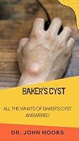 Algopix Similar Product 14 - BAKERS CYST ALL THE WHATS OF BAKERS