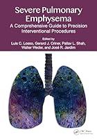 Algopix Similar Product 4 - Severe Pulmonary Emphysema A