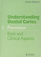 Algopix Similar Product 16 - Understanding Dental Caries Vol 2
