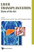 Algopix Similar Product 7 - Liver Transplantation: State of the Art