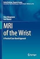 Algopix Similar Product 6 - MRI of the Wrist A Practical