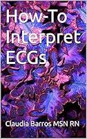 Algopix Similar Product 19 - How-To Interpret ECGs